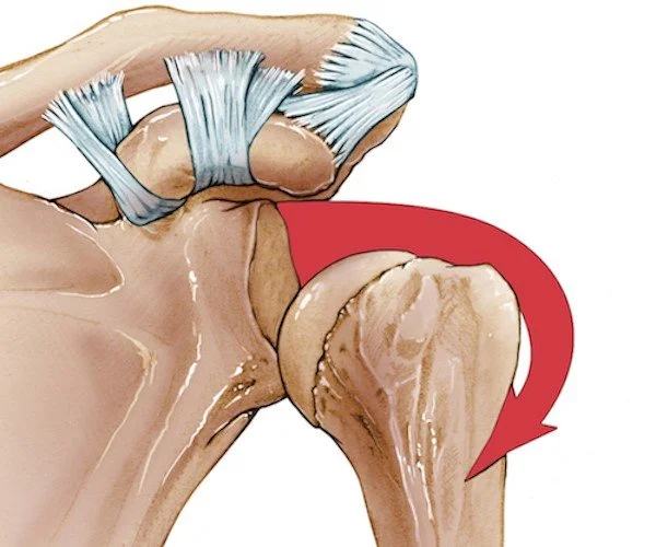 Shoulder Instability Among Athletes — Mending Playbook