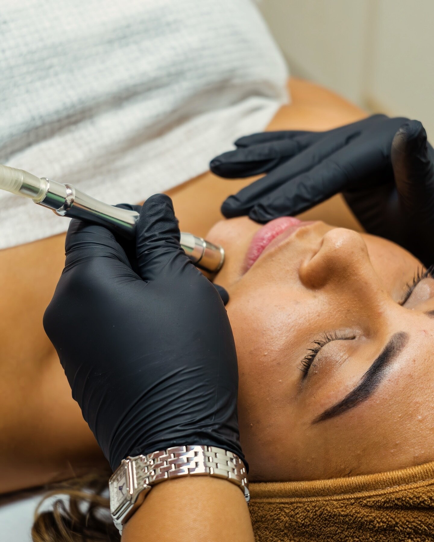 💎💆🏽&zwj;♀️☀️💆🏼&zwj;♀️Most people have experienced a Microdermabrasion facial, it uses a crushed diamond tip and wand powered with suction to vacuum away the dead skin cells from the top layer of your skin, what we have done is combine it into a 
