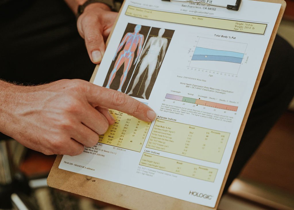 DEXA Scan