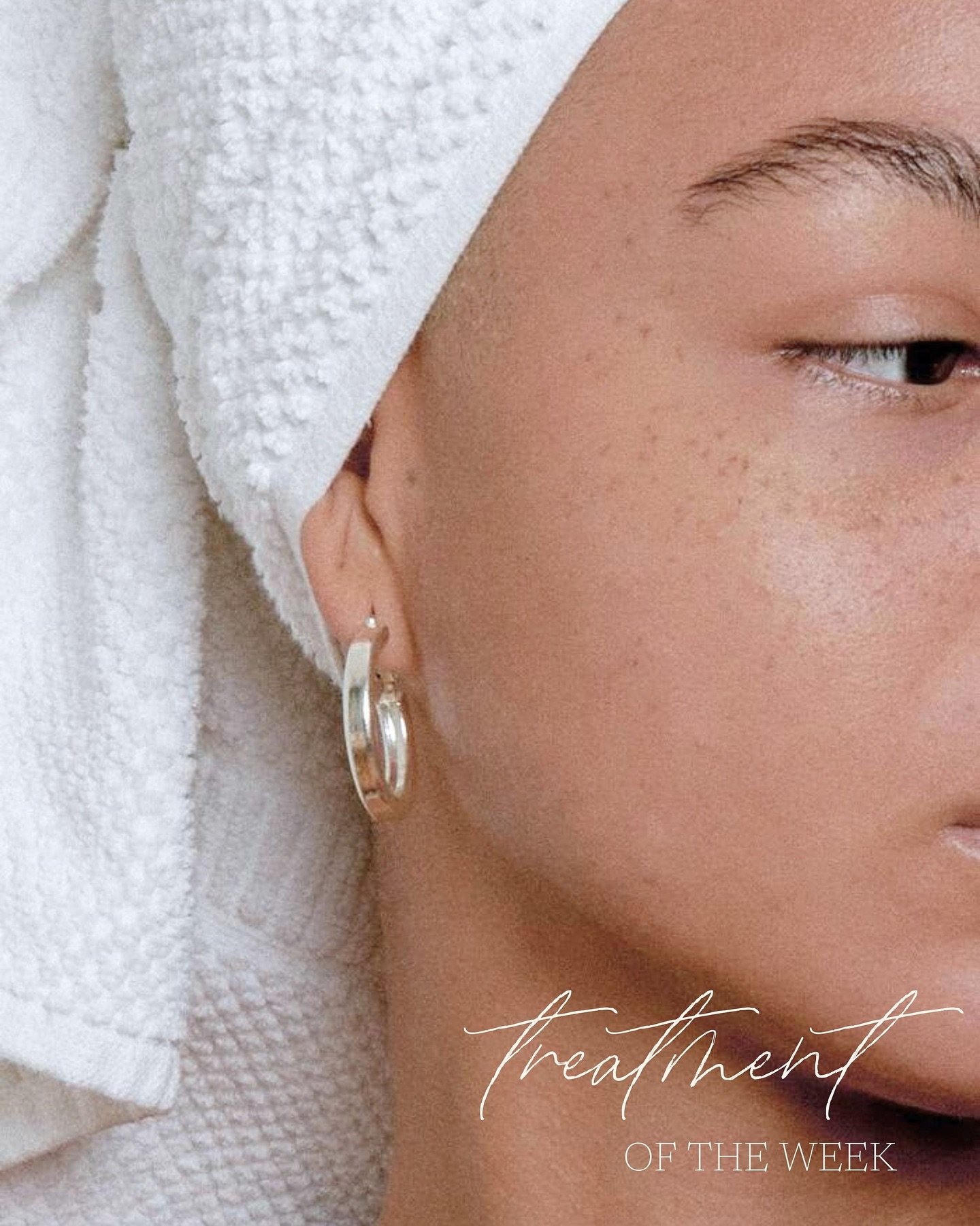 We hear you__
Your skin feels tired, congested or unbalanced and it can be so discouraging when nothing seems to work. That&rsquo;s exactly why we LOVE BioRePeel. 

It&rsquo;s gentle yet powerful, helps rebuild your glow from the inside out and gives