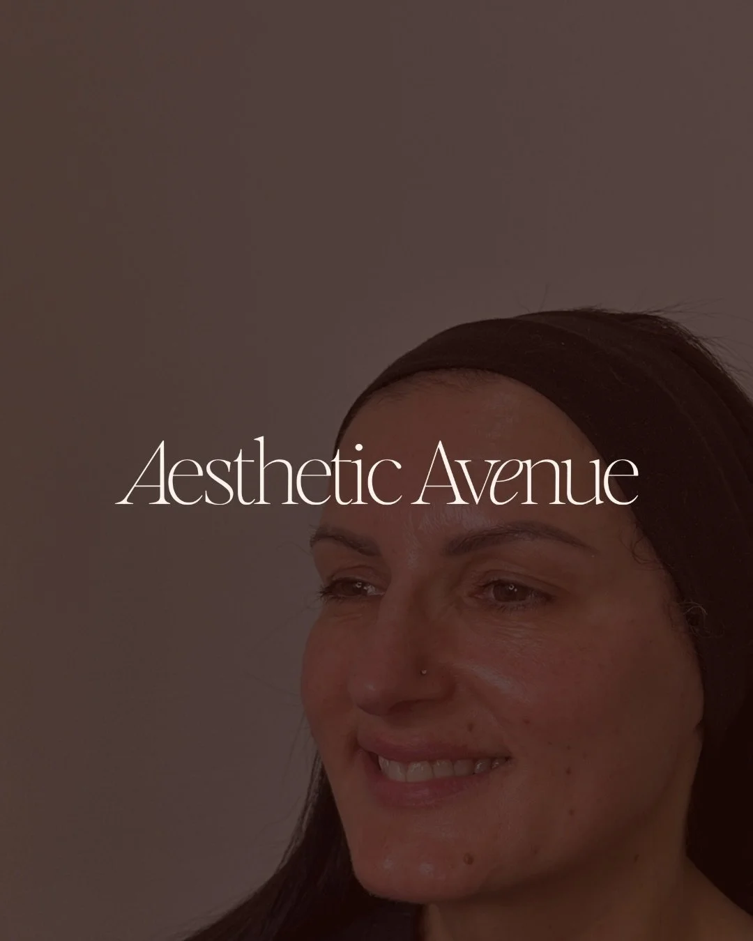 Aesthetic Avenue is a Senior Registered Nurse&ndash;led aesthetic clinic. All treatments are performed or overseen by qualified medical professionals, and each plan is developed following a thorough clinical consultation.

The outcomes shown represen