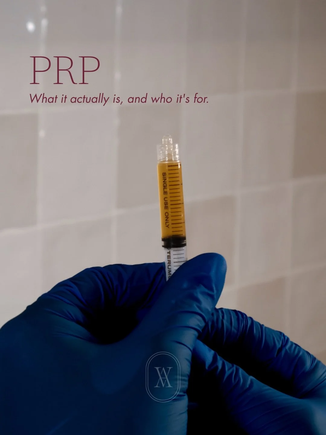 PRP works best for those in the earlier stages of thinning, where follicles are weakened but not dormant, rather than as a solution for complete hair loss.

At Aesthetic Avenue, we assess your scalp and hair pattern individually before recommending P
