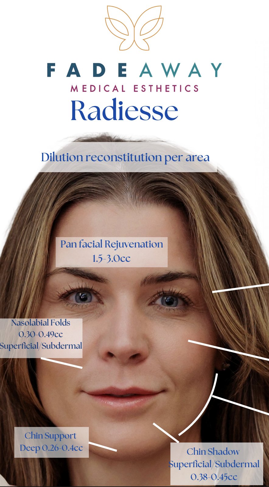 Radiesse Mapping Chart