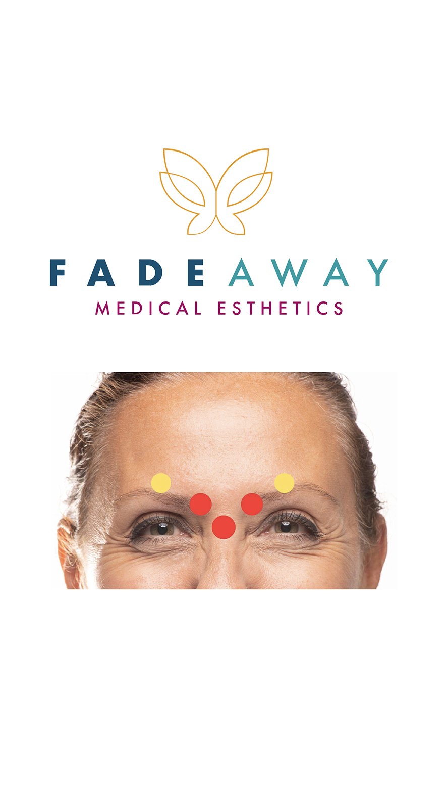 Neurotoxin Quick Reference