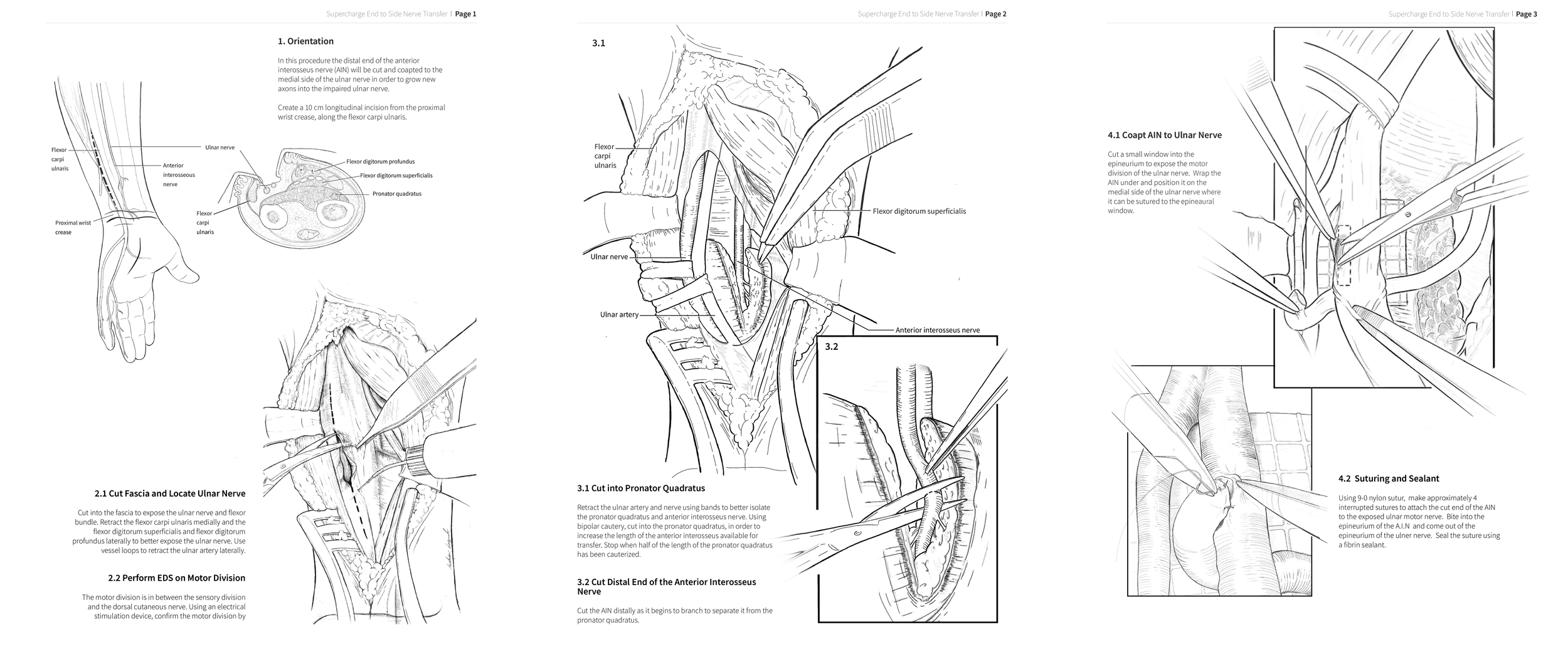 MSC2001Y-Assignment_5_Janeczek_Andrew_Layout copy.png