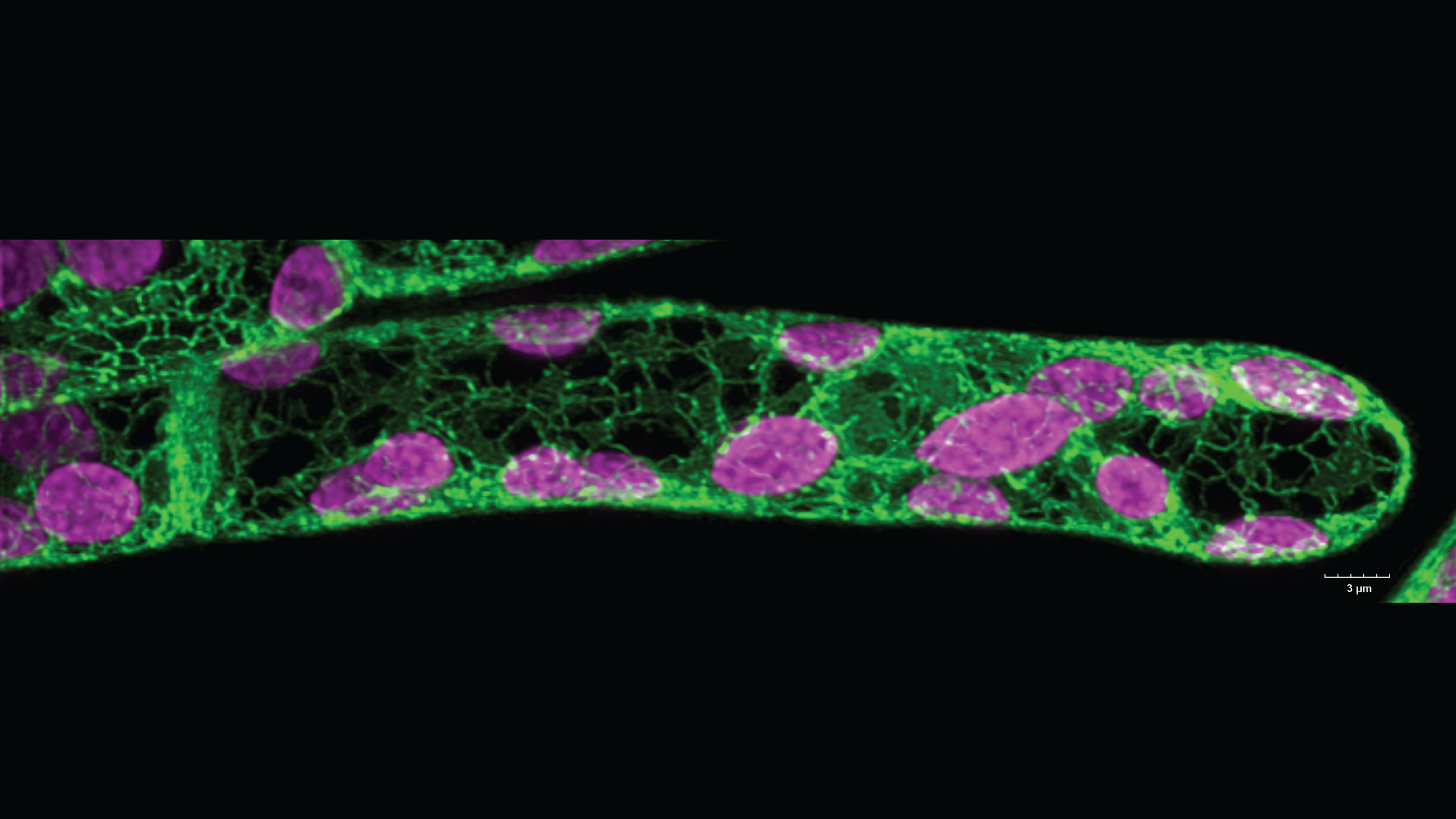 An undergraduate student in the lab, Andy Marchant, made this awesome image of a moss (Physcomitrium patens) apical chloronema cell. 
This is a beautiful example of how the ER network looks in plant cells (in green). The chlorophyll autofluorescence 