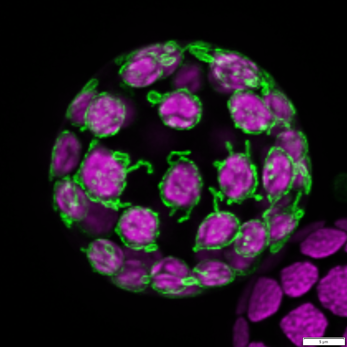 Moss (Physcomitrium patens) protoplasts (wallless cells) transformed with chloroplast envelope protein tagged with mGFP (green). The chlorophyll autofluorescence is in magenta.
The protrusions of the chloroplast envelope are called stromules. 
This i