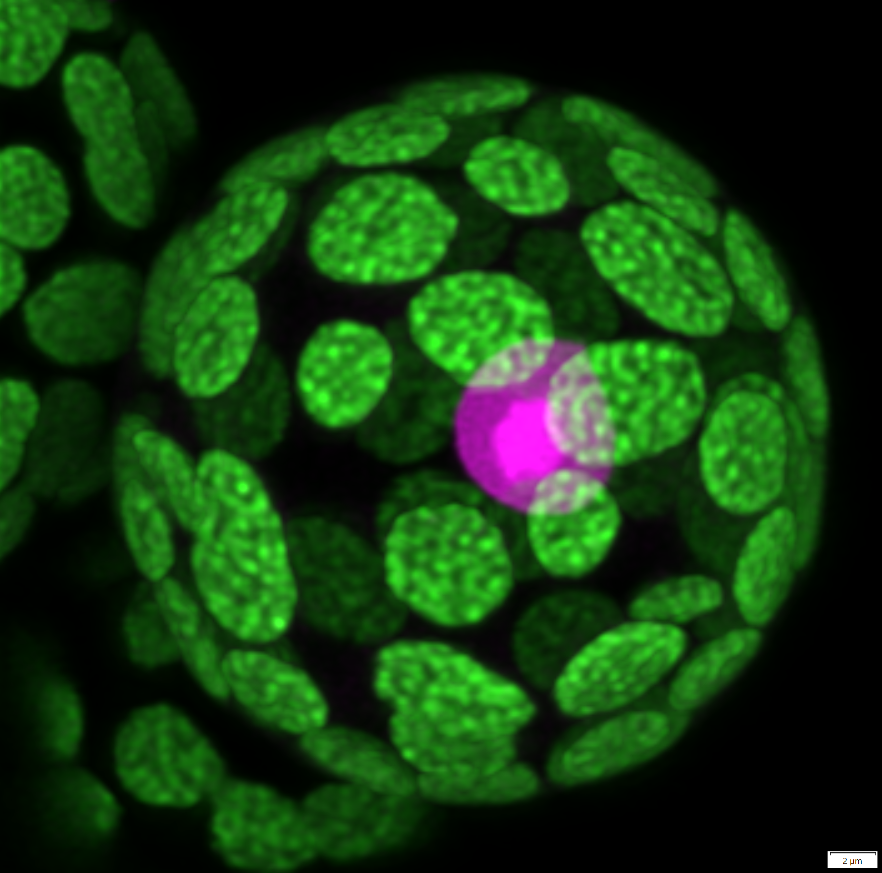 This is a moss (Physcomitrium patens) protoplast (wall-less cell) transformed with a nuclear marker (in magenta). The much brighter area is the nucleolus. The chlorophyll autofluorescence is in green. This is a deconvolved Z-maximum projection of an 