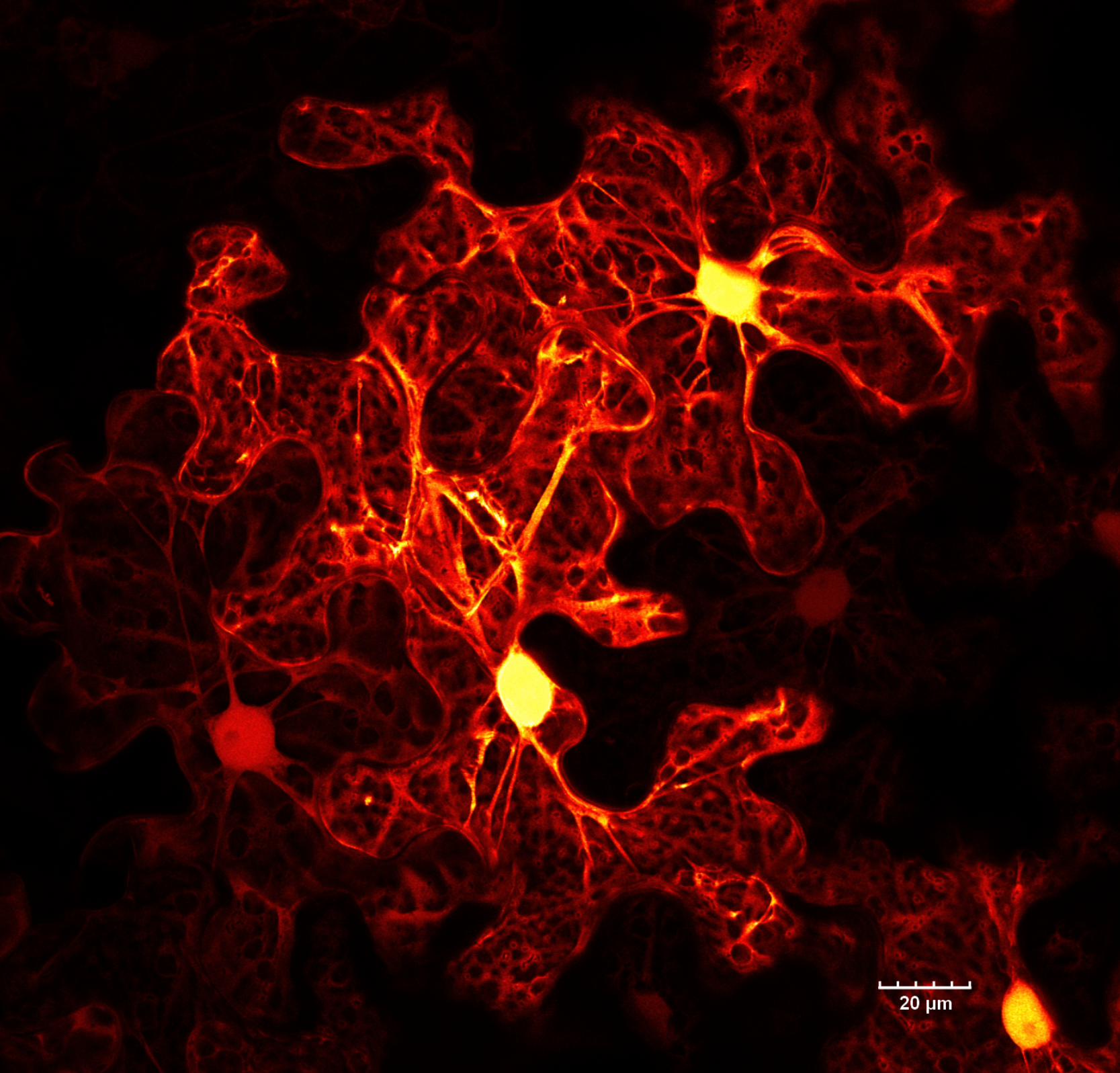 These epidermal cells of tobacco (Nicotiana benthamiana) leaf are expressing cytosolic GFP. The brightest region is the nucleus, which is surrounded by a large central vacuole. The cytosol is restricted to the cell periphery. Transvacuolar strands co