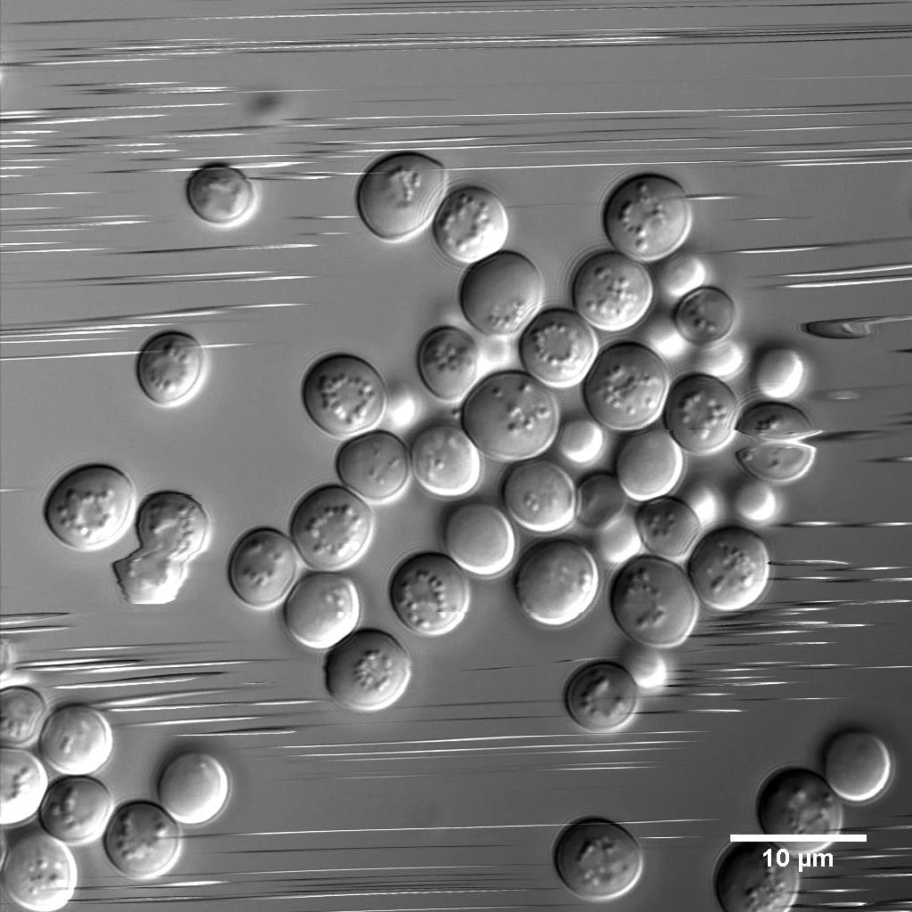 These Brewer's yeast cells were in a hurry! 
This was captured with a point-scanning confocal microscope, which scans one point (pixel) at a time, moving from left to right and top to bottom. As a consequence, cells moving faster than the scan speed 