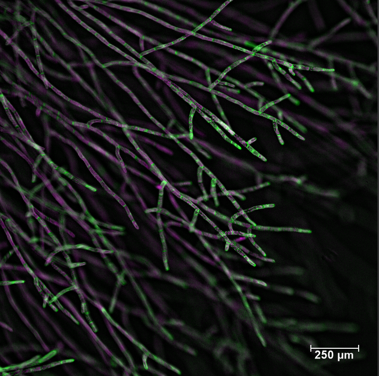 This is a section of juvenile moss (Physcomitrium patens) tissue, called protonemata. The apical cells expand by tip-growth, while subapical cells sometimes divide to make lateral filaments.
Cytosolic GFP is in green, and chlorophyll autofluorescence