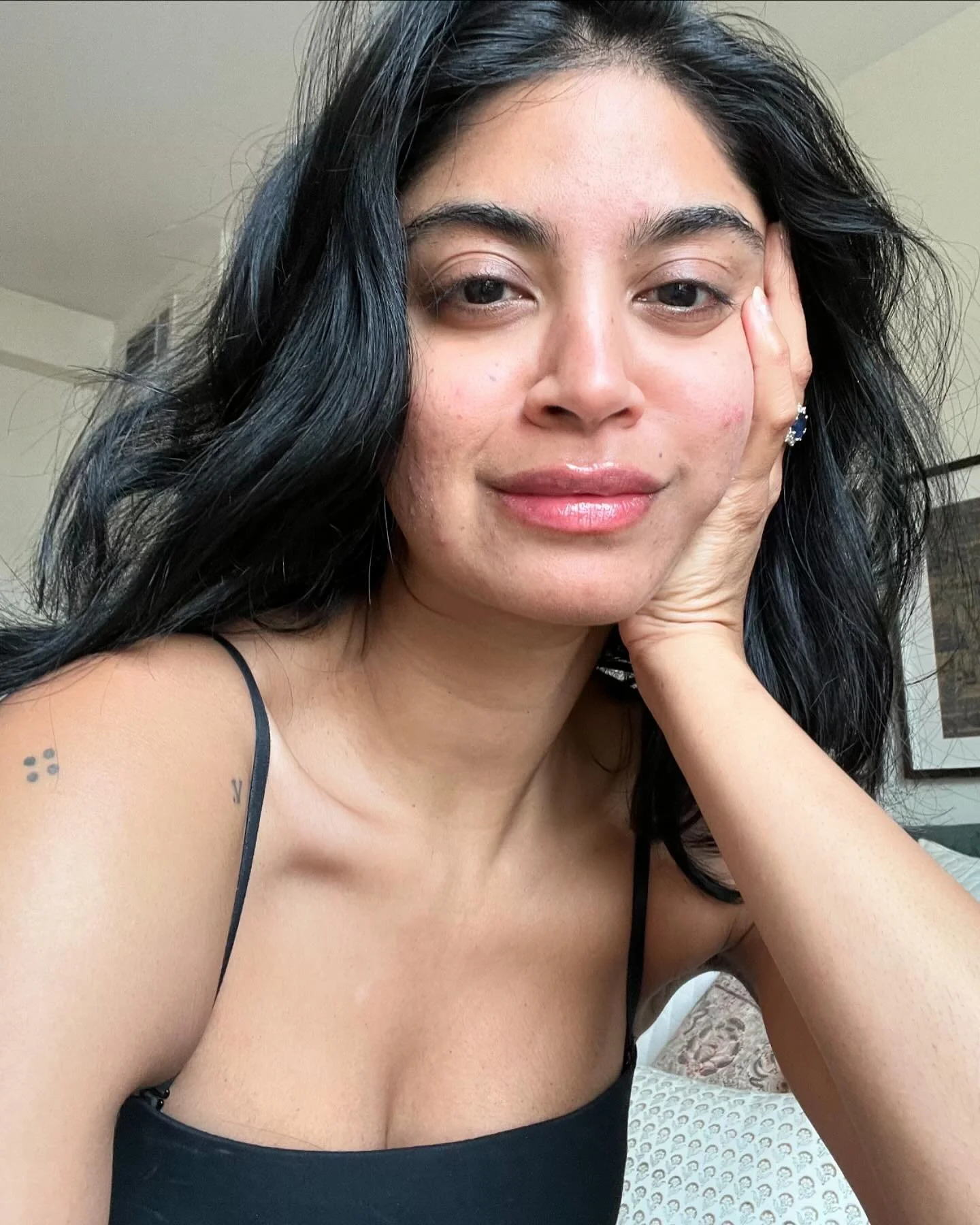 Acne is cool and all but girl I was not prepared for the Accutane purge 😭 and the way no one warned me (well my doctor told me but I thought &lsquo;wouldn&rsquo;t be me&rsquo;) 

What did yall do??