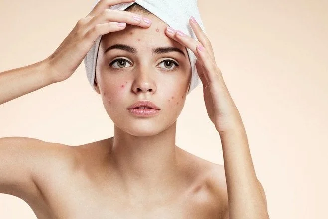 Calm inflammation and clear active acne with Fotona laser therapy—targeting bacteria, reducing redness, and promoting faster skin healing without downtime.