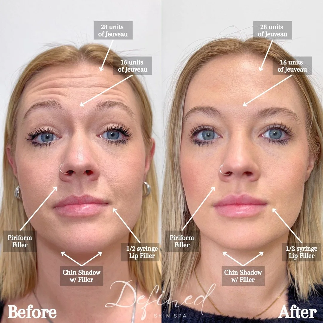 Copy of Before.png.jpeg