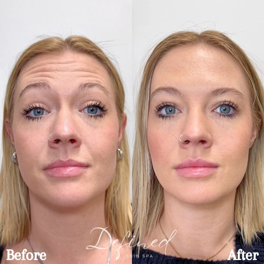 Copy of Before.zip - 3.jpeg