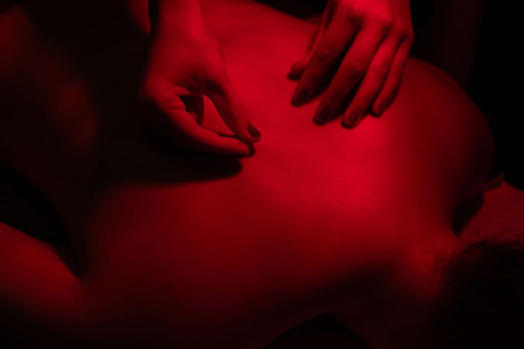 Acupuncture Gold Coast.jpg