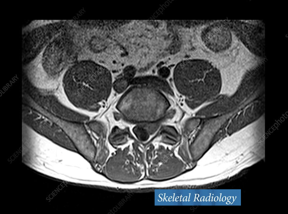 How do core muscles differ between active and inactive people?