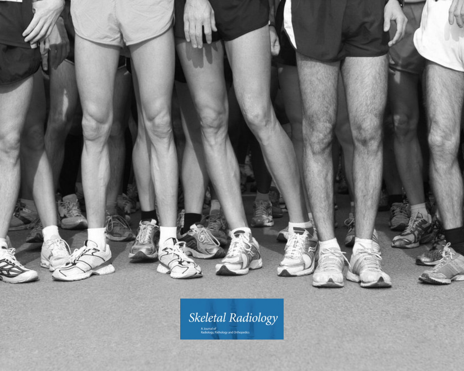 What happens to marathon runners’ knees in the long term? — Exercise ...