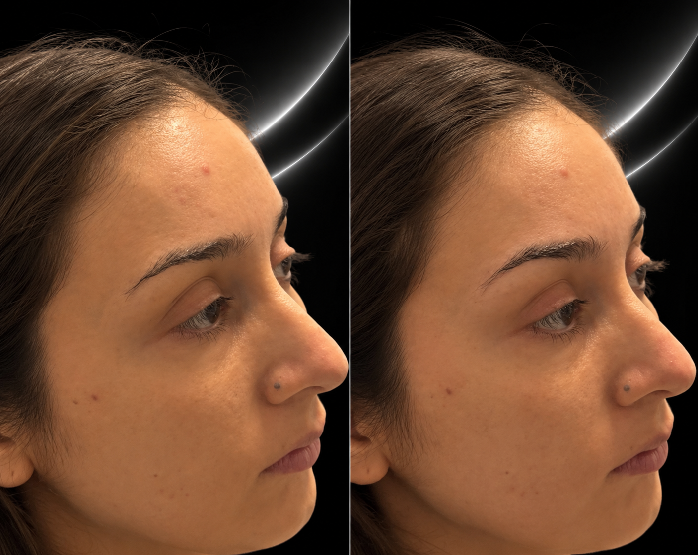 Comparison of a woman's profile before and after skincare treatment, showing smoother skin and less blemishes.