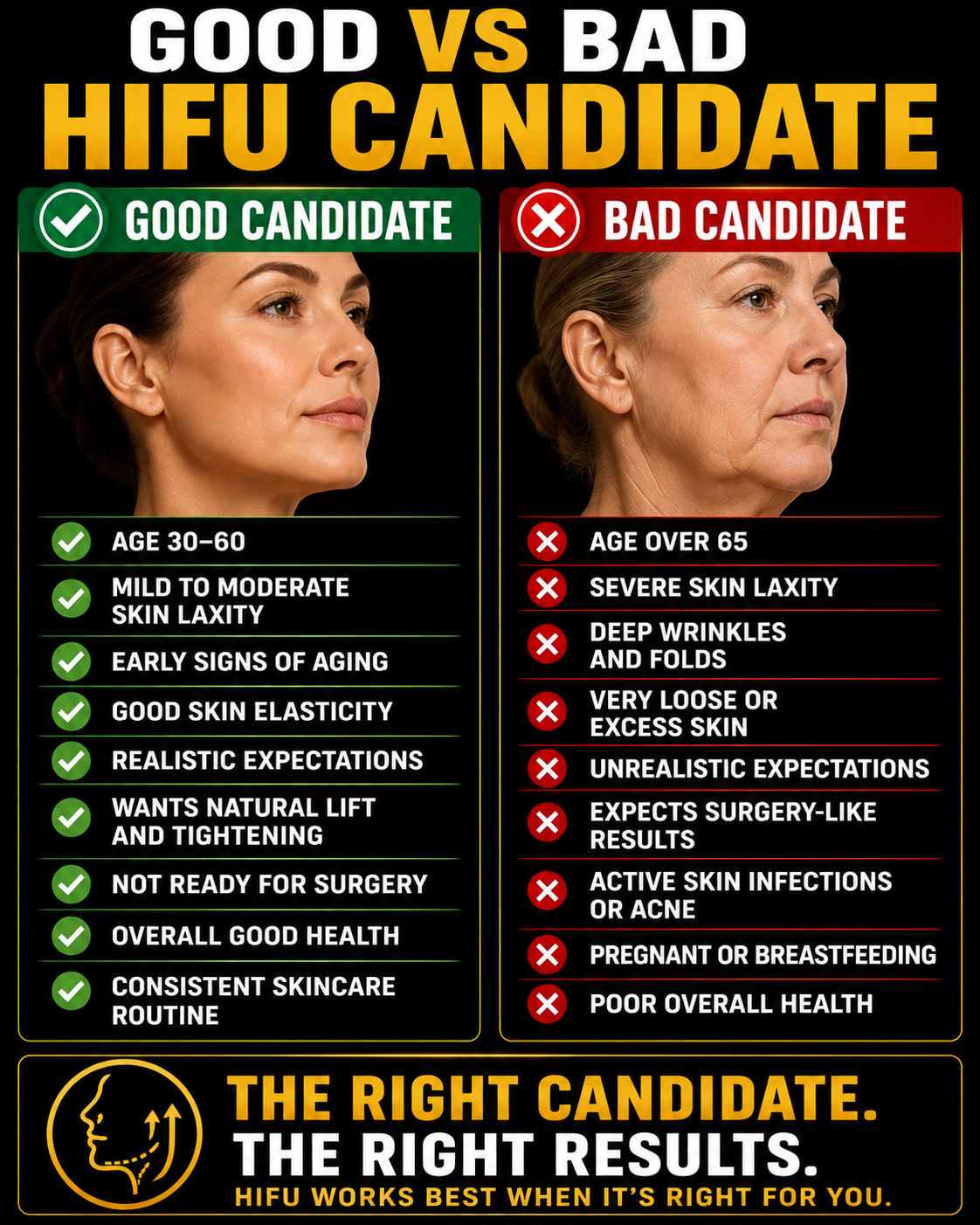 Comparison chart of good versus bad candidates for HIFU treatment, showing a side profile of a woman with better skin on the left and sagging skin on the right. The chart lists age, skin laxity, signs of aging, skin elasticity, expectations, health, and readiness for surgery.