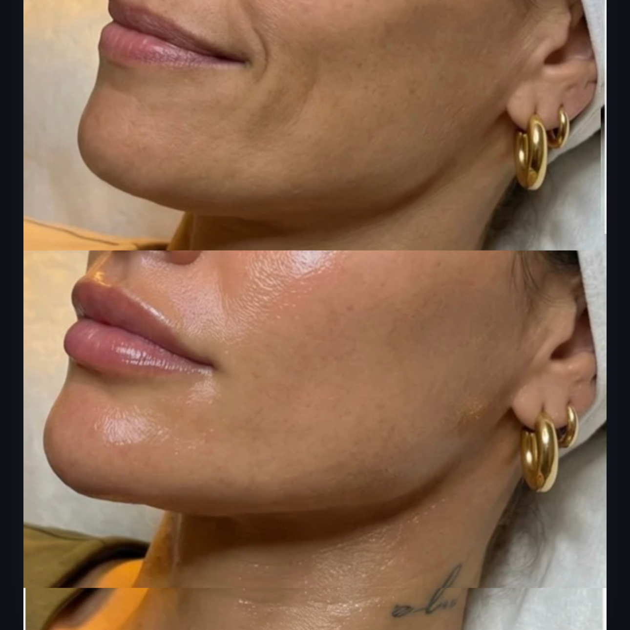 Close-up of a woman's face showing a before and after comparison of skincare or cosmetic treatment, highlighting improved skin texture and glow.