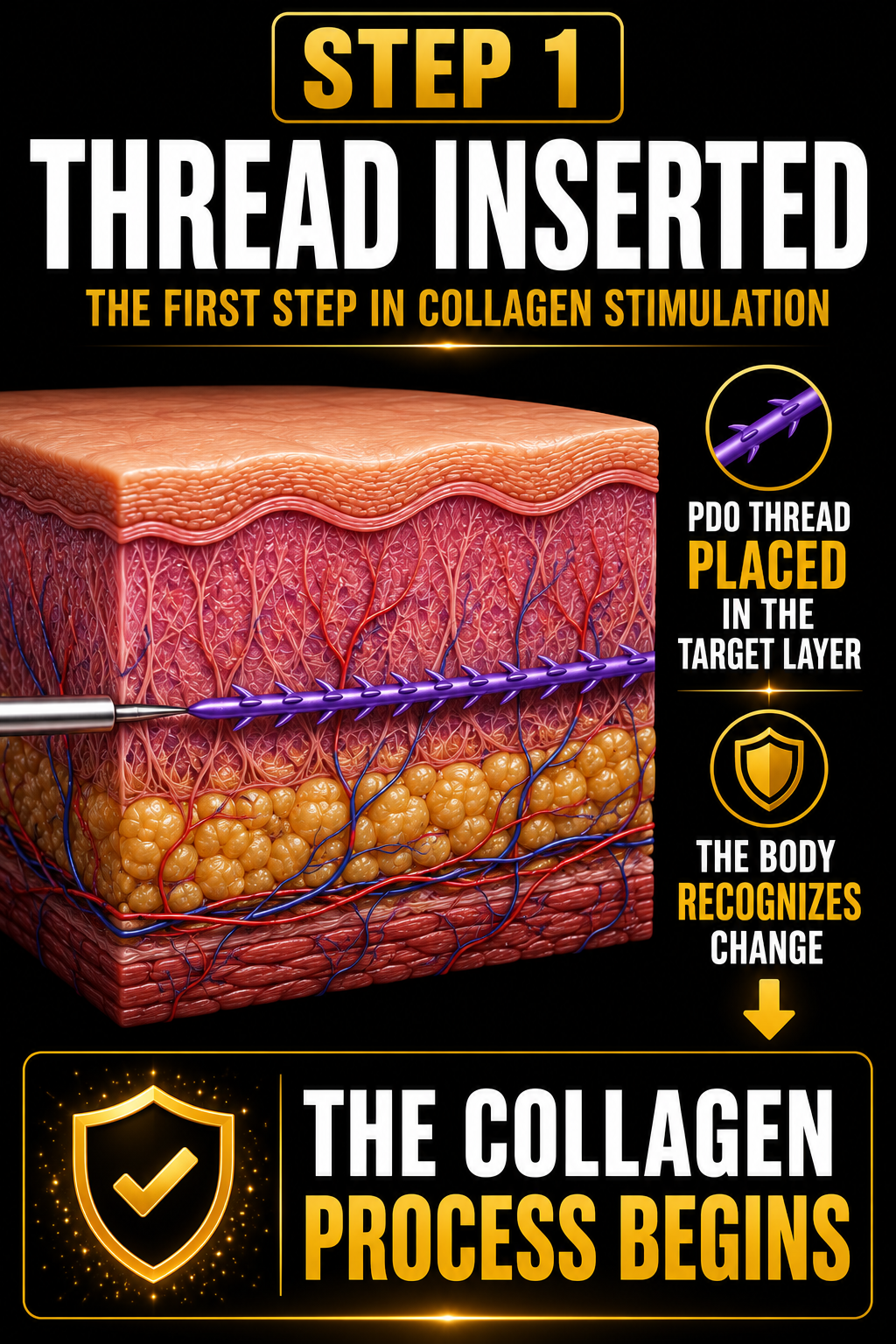Diagram showing the first step in collagen stimulation, with a PDO thread placed in the target layer of the skin, and a shield icon indicating recognition of change by the body, with text explaining the process.
