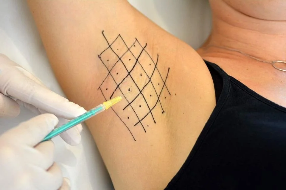 A person is getting a tattoo of a grid pattern with small dots on their upper arm by a tattoo artist wearing gloves.