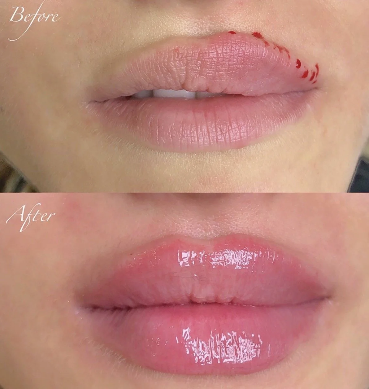 Close-up of lips before and after applying lip gloss, with the top image showing dry lips with red marks and the bottom image showing shiny, glossy lips.