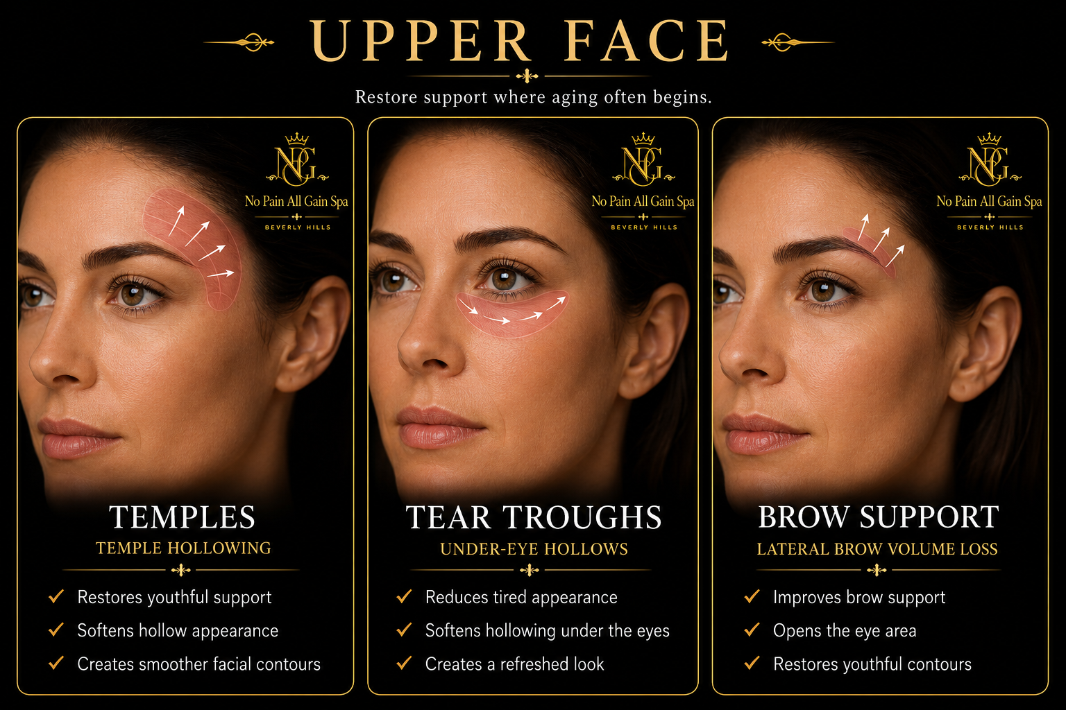 Infographic highlighting skincare solutions for upper face aging. It features three images of a woman with brown hair and brown eyes, illustrating treatments for temples, tear troughs, and brow support. The left image shows temple hollows with arrows pointing inward, the middle image depicts under-eye hollows with curved arrows, and the right image displays brow support with arrows indicating lifting. Each section lists benefits such as restoring support, softening appearance, reducing tiredness, and improving brow support.