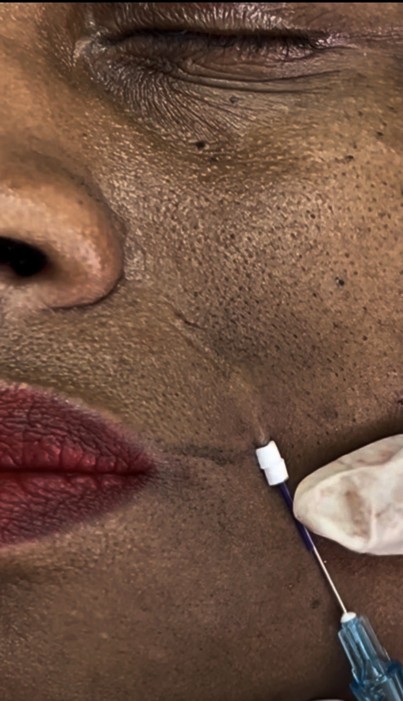 Close-up of a person's face with dark skin, red lipstick, a closed eye with black eye makeup, and a nose with visible pores. A medical syringe with a blue needle cap is near the person's mouth, being held by a gloved hand.