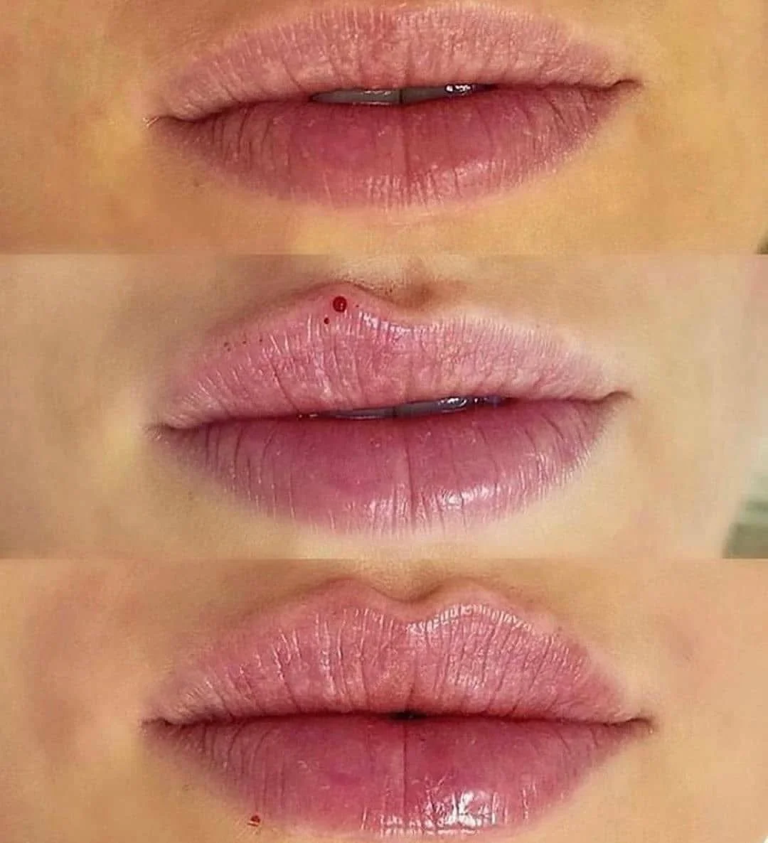Close-up of human lips, showing three different states: slightly parted, slightly open with small blood drop on upper lip, and closed.