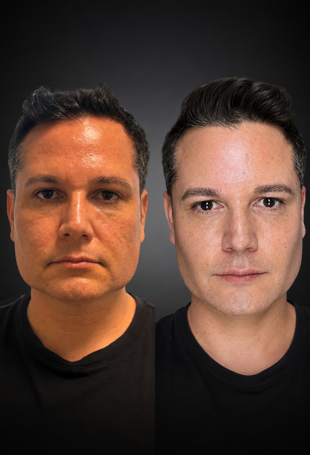 Side-by-side comparison of two men with different skin textures and hair styles, both wearing black shirts against a dark background.