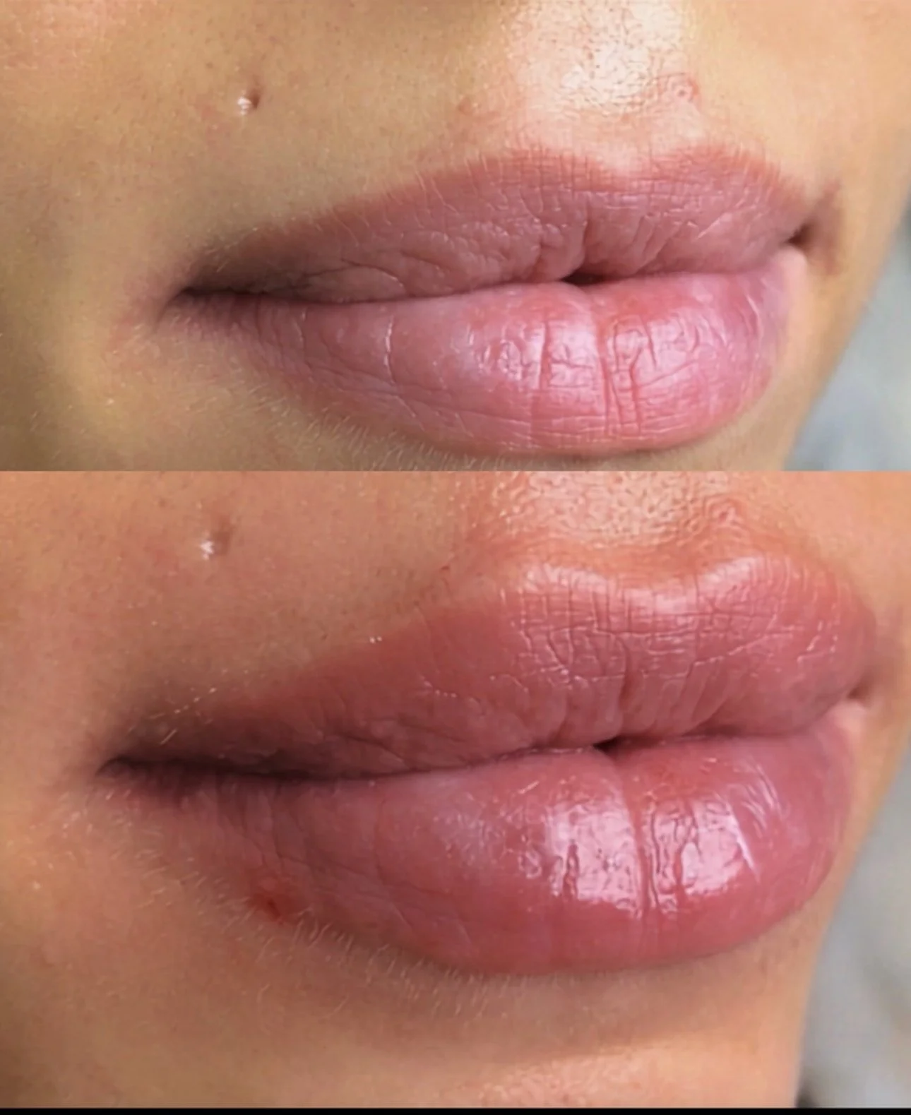 Close-up of lips and surrounding skin, showing different skin textures and natural appearance, with a small mole above the lips.