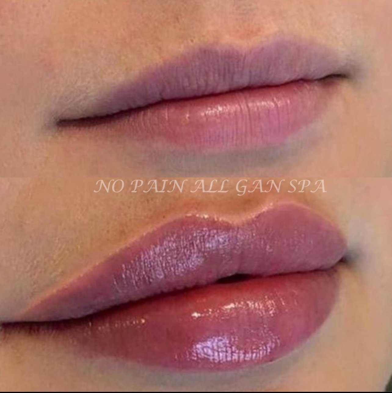 Close-up of a person's lips with glossy, pink lipstick and the text 'NO PAIN ALL GANA SPA' overlaid.