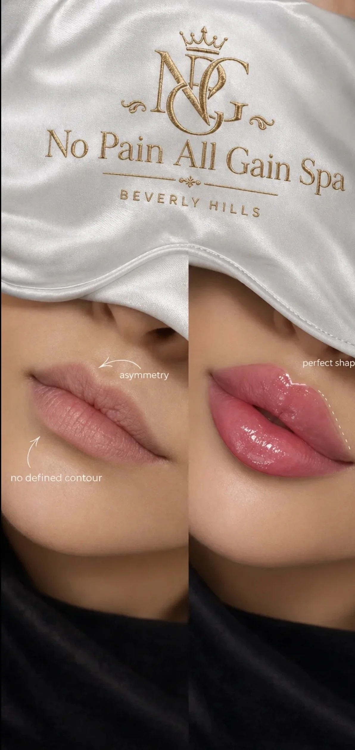 Comparison of two lips, one with asymmetry and no defined contour, and the other with perfect shape and glossy finish, emphasizing lip enhancement or makeup effects.