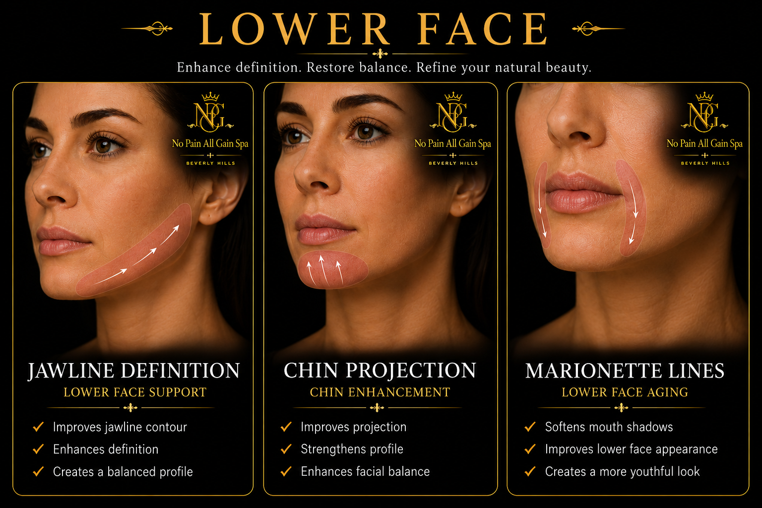 Advertisement for lower face treatments featuring three women with highlights on targeted areas, accompanied by text explaining benefits such as jawline definition, chin projection, and marionette lines, and their respective advantages.