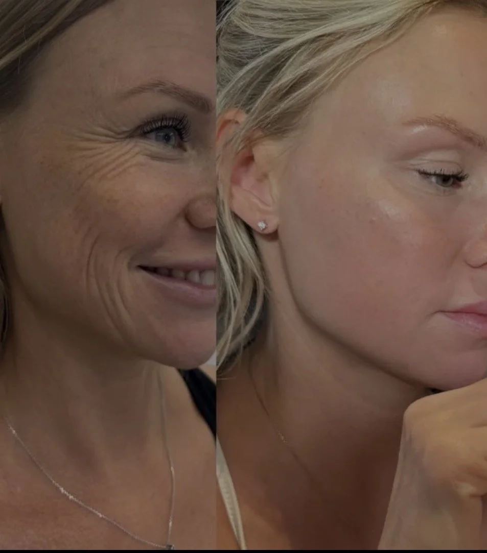 Close-up of two women with blonde hair, one smiling with visible wrinkles and the other looking thoughtful with her hand near her face.