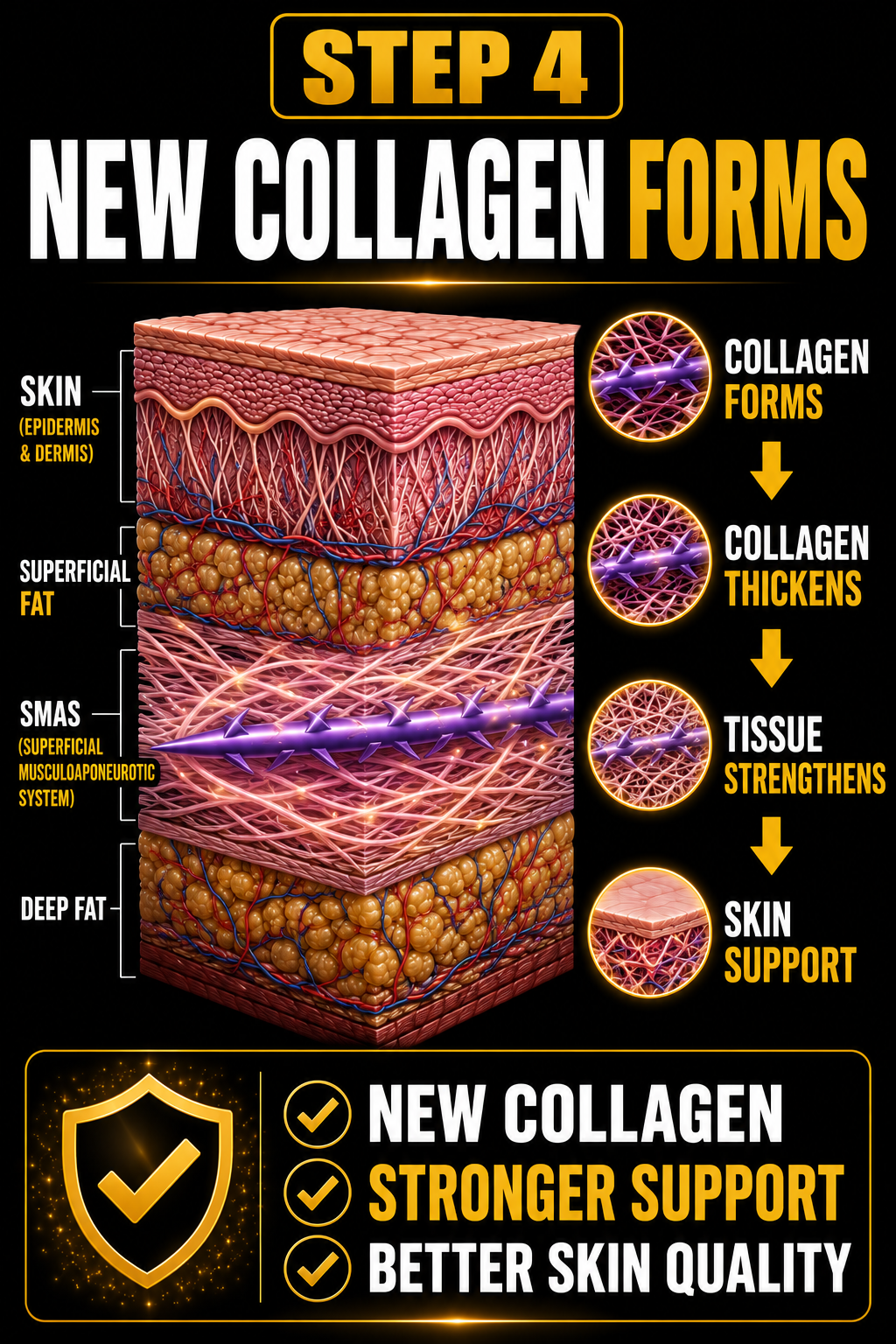 Diagram illustrating the process of new collagen formation in the skin, showing skin layers and how collagen thickens tissue to strengthen skin support, with steps highlighting collagen forming, thickening, and tissue strengthening.