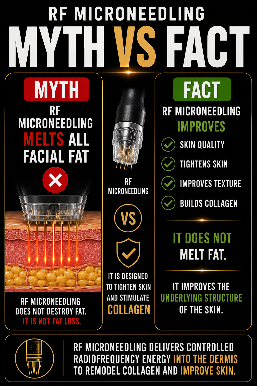 Comparison infographic between myth and fact about RF microneedling, showing that myths claim it melts facial fat, while facts state it improves skin quality, tightens skin, improves texture, and builds collagen without melting fat.