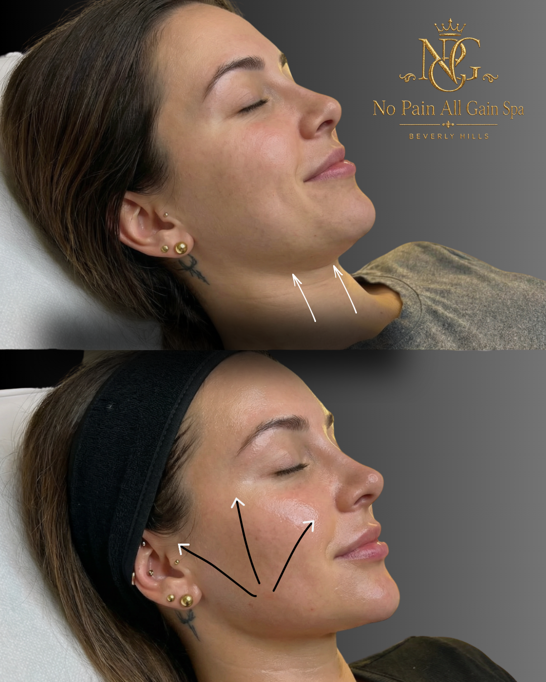 Side-by-side images of a woman with closed eyes, showing her face and neck before and after a facial treatment. The top image shows her with no headband and arrows pointing to her neck, with a logo that says 'No Pain All Gain Spa Beverly Hills'. The 