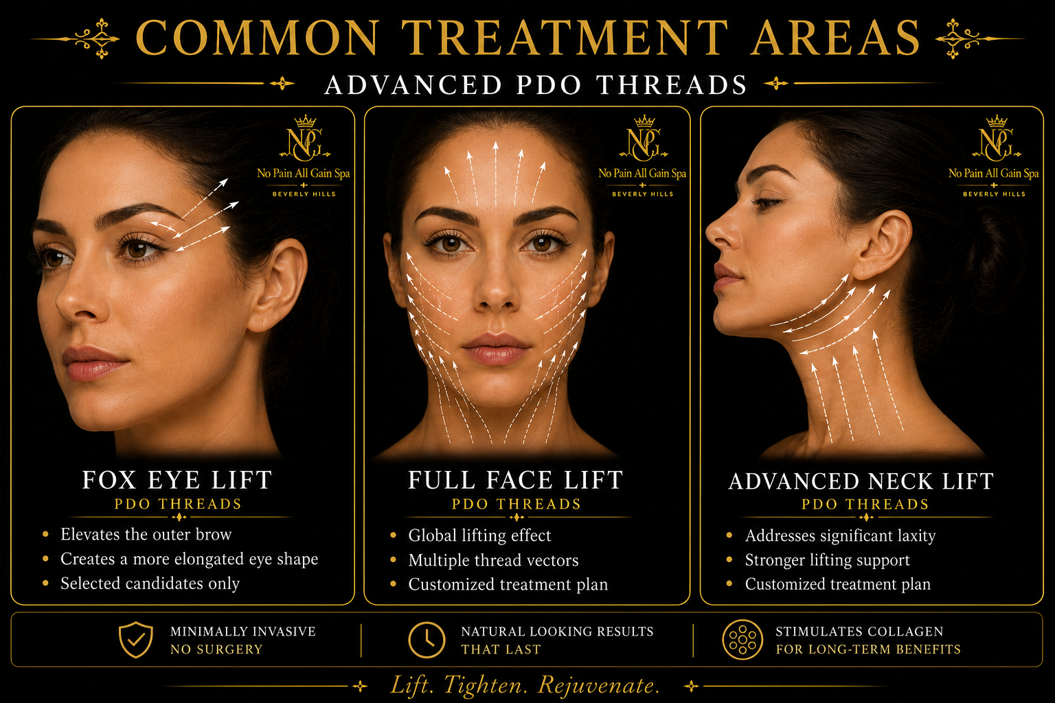 Chart showing common treatment areas for PDO threads with three images of a woman with arrows indicating points for Fox Eye Lift, Full Face Lift, and Advanced Neck Lift treatments. Text highlights benefits such as no surgery, natural results, and collagen stimulation.