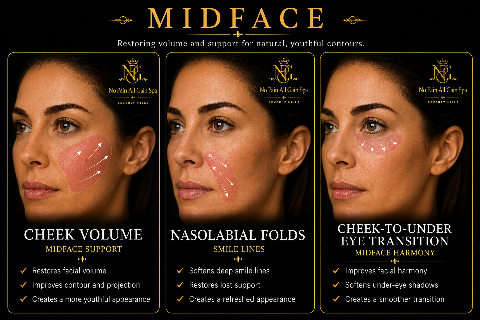 An advertisement for a skincare product called Midface from No Pain All Gain Spa in Beverly Hills. It features three images of a woman's face demonstrating different facial support techniques: cheek volume, nasolabial folds, and cheek-to-under eye transition. Each section includes bullet points describing the benefits of each technique such as restoring facial volume, softening deep smile lines, and improving facial harmony.