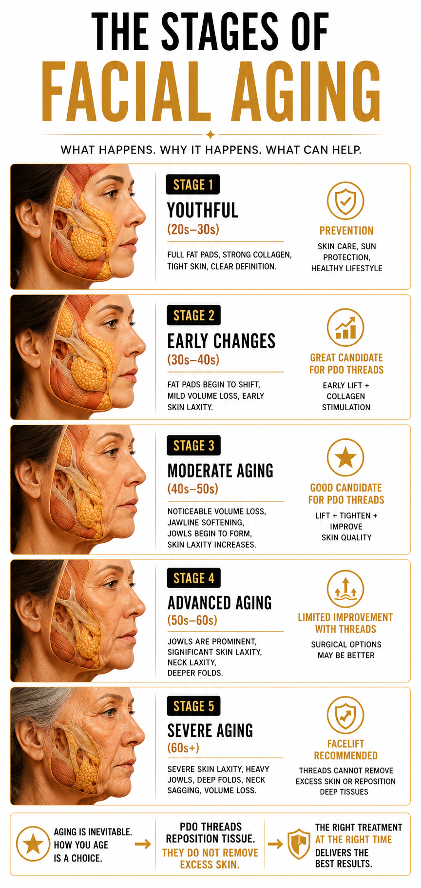 An infographic titled "The Stages of Facial Aging" showing five stages of facial aging with illustrations of a woman's face and detailed descriptions of characteristics and recommended treatments at each stage.