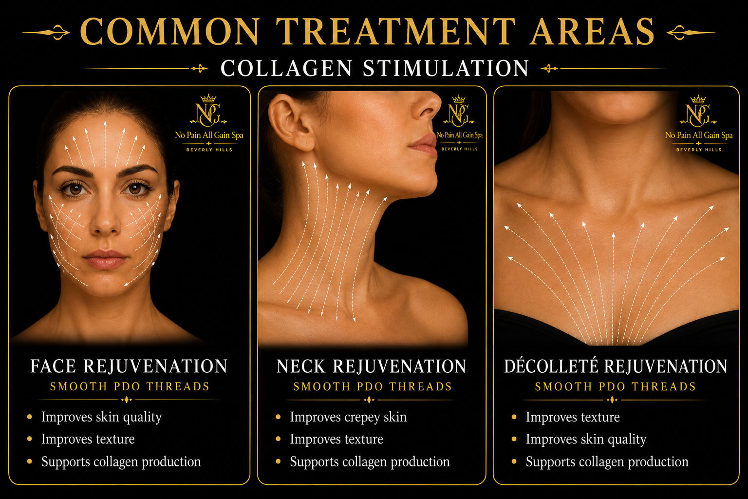 Diagram of common treatment areas for collagen stimulation showing face, neck, and décolleté with arrows indicating treatment zones. Text highlights benefits such as skin improvement, texture, and collagen support.