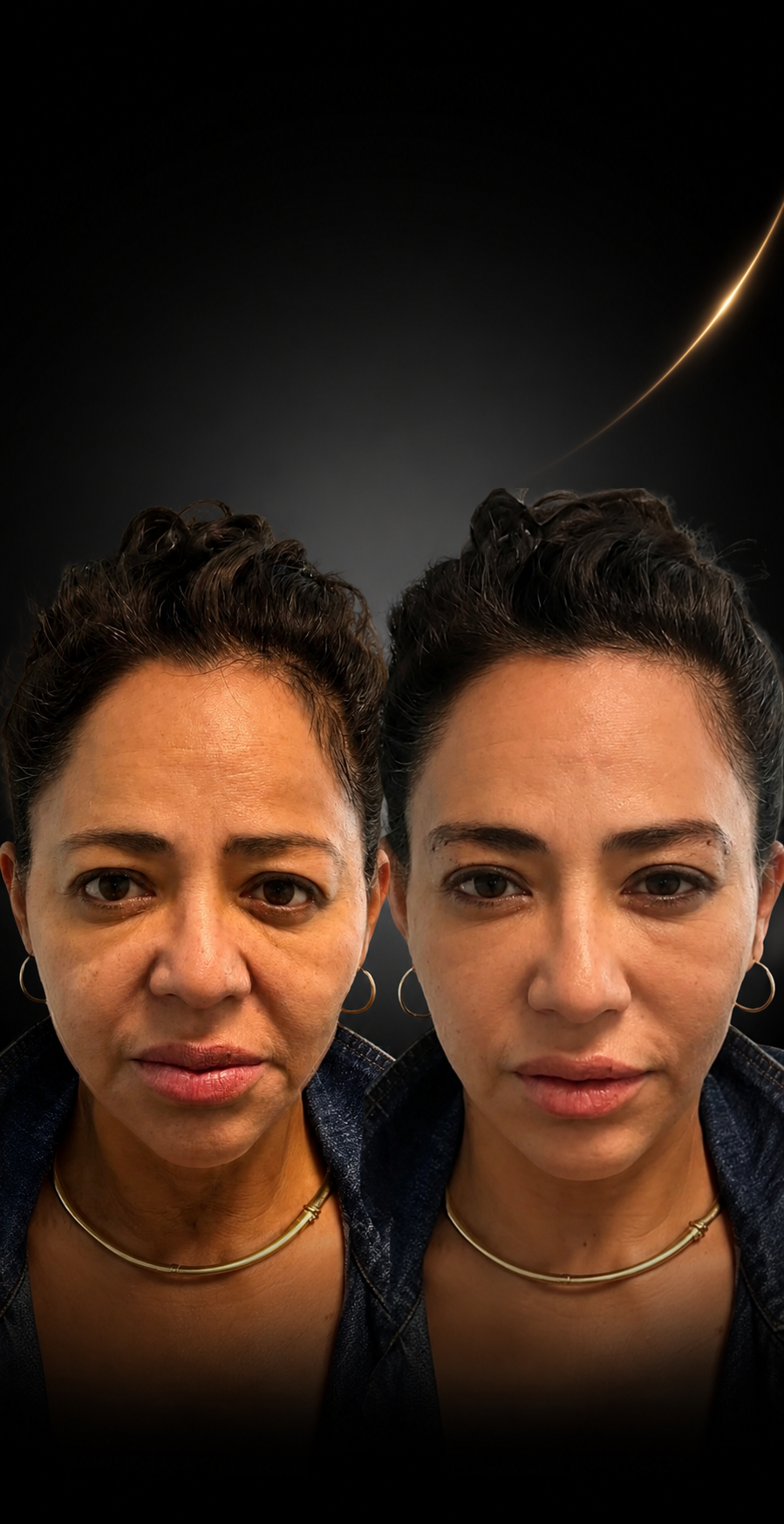 A side-by-side comparison of a woman before and after a skincare or cosmetic treatment, with a black background and a faint light streak in the top right corner.
