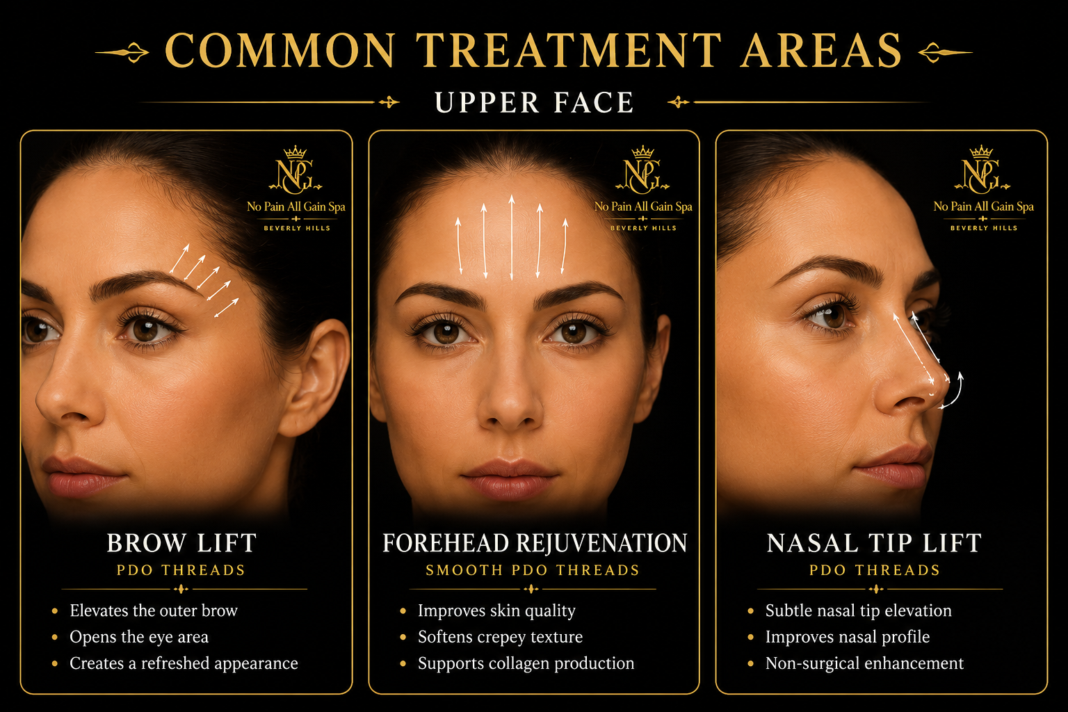 Poster outlining common treatment areas for upper face, including brow lift with PDO threads, forehead rejuvenation with smooth PDO threads, and nasal tip lift with PDO threads, with descriptions of benefits for each