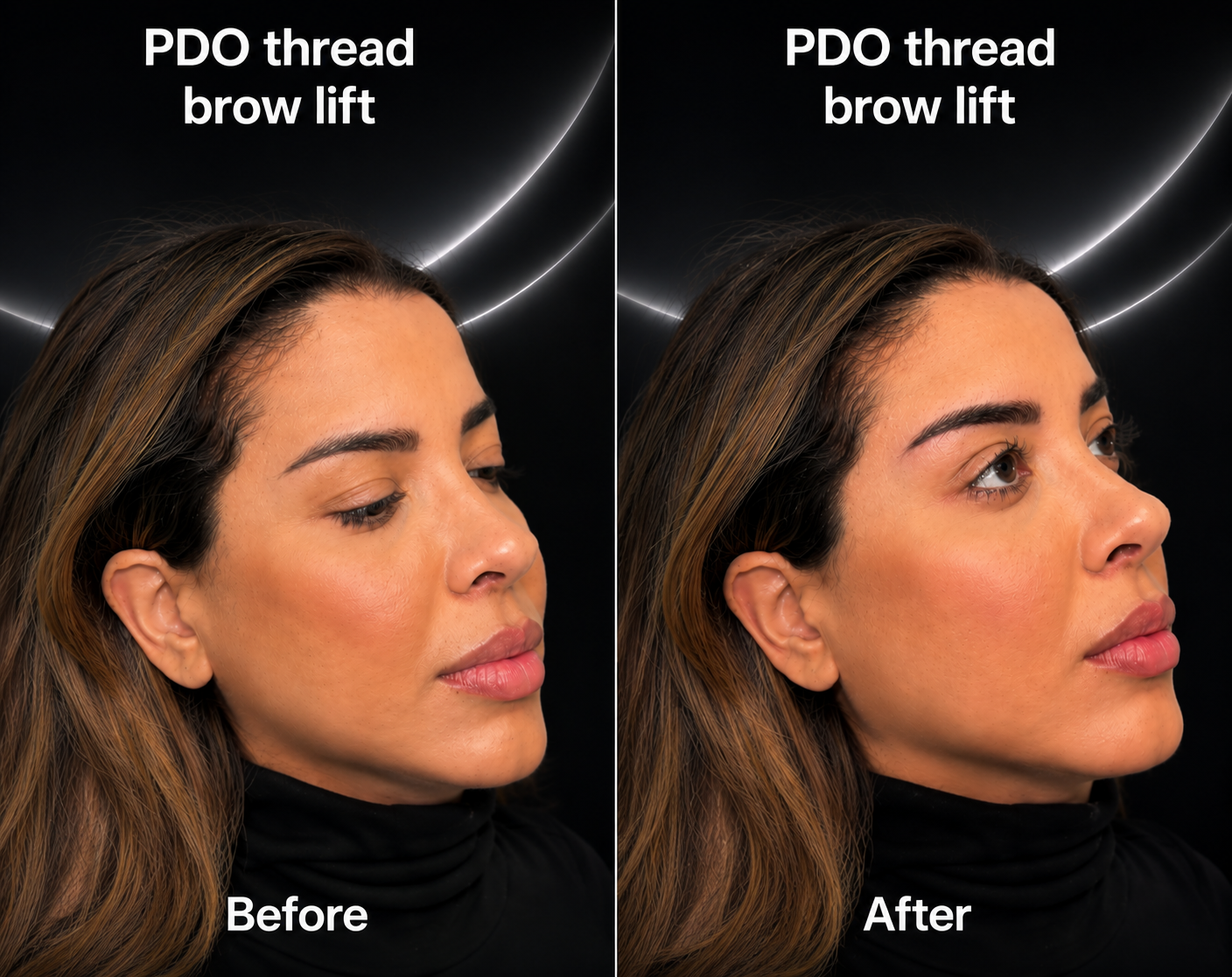 Side-by-side comparison of a woman's face showing benefit of PDO thread brow lift, with before and after images. The woman has light skin and brown hair, with the after image showing a slightly lifted brow arch.