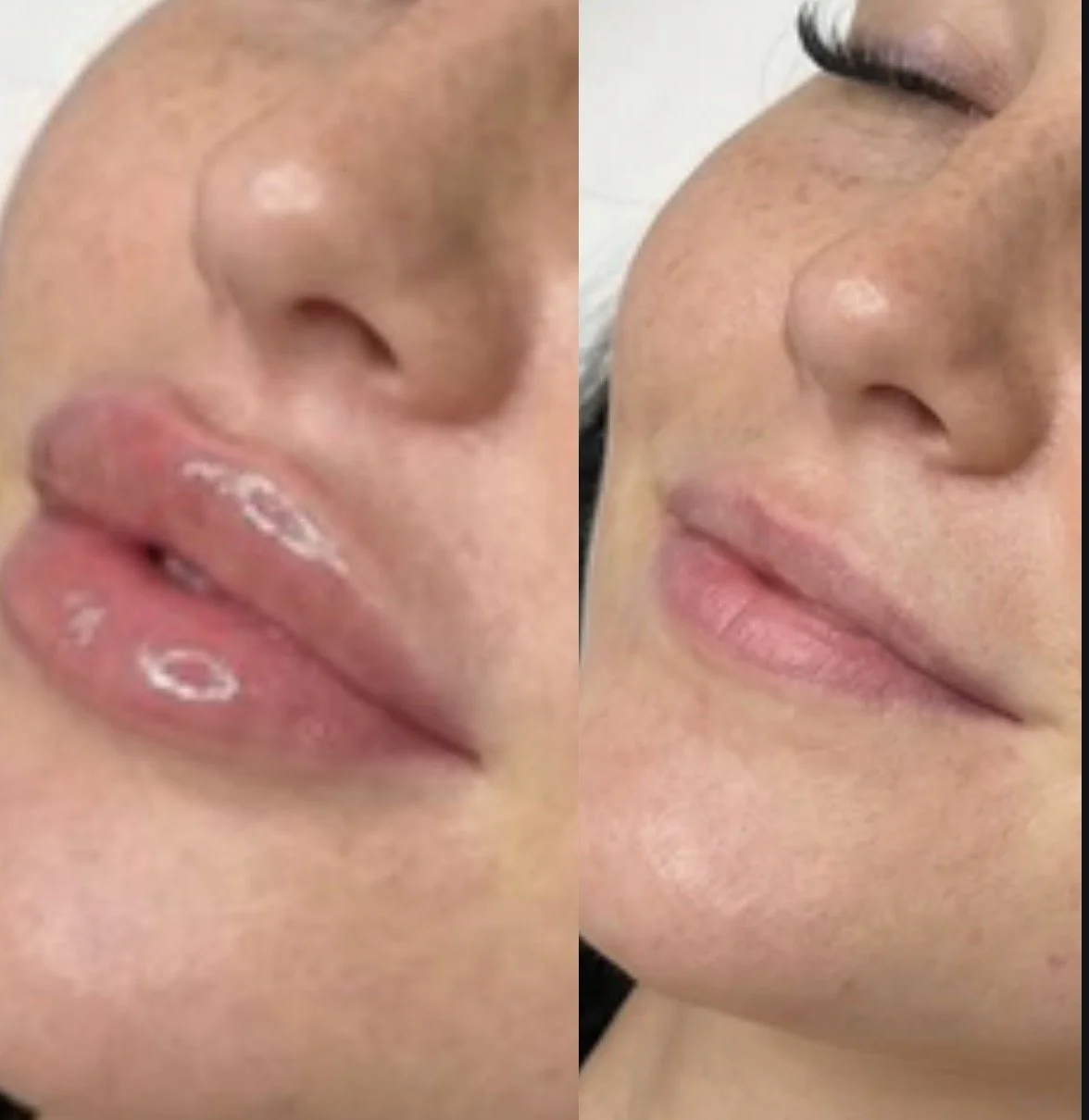 Close-up of a woman's face showing a before-and-after comparison of lip hydration, with dry, chapped lips on the left and smooth, moisturized lips on the right.