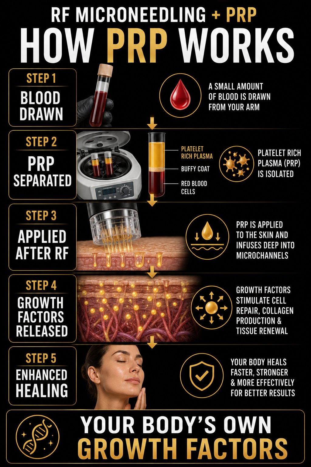 An infographic explaining how PRP (Platelet-Rich Plasma) works with five steps: 1. Blood drawn from arm; 2. PRP separated with centrifuge; 3. PRP applied to skin; 4. Growth factors released stimulating cell repair; 5. Enhanced healing with faster recovery.