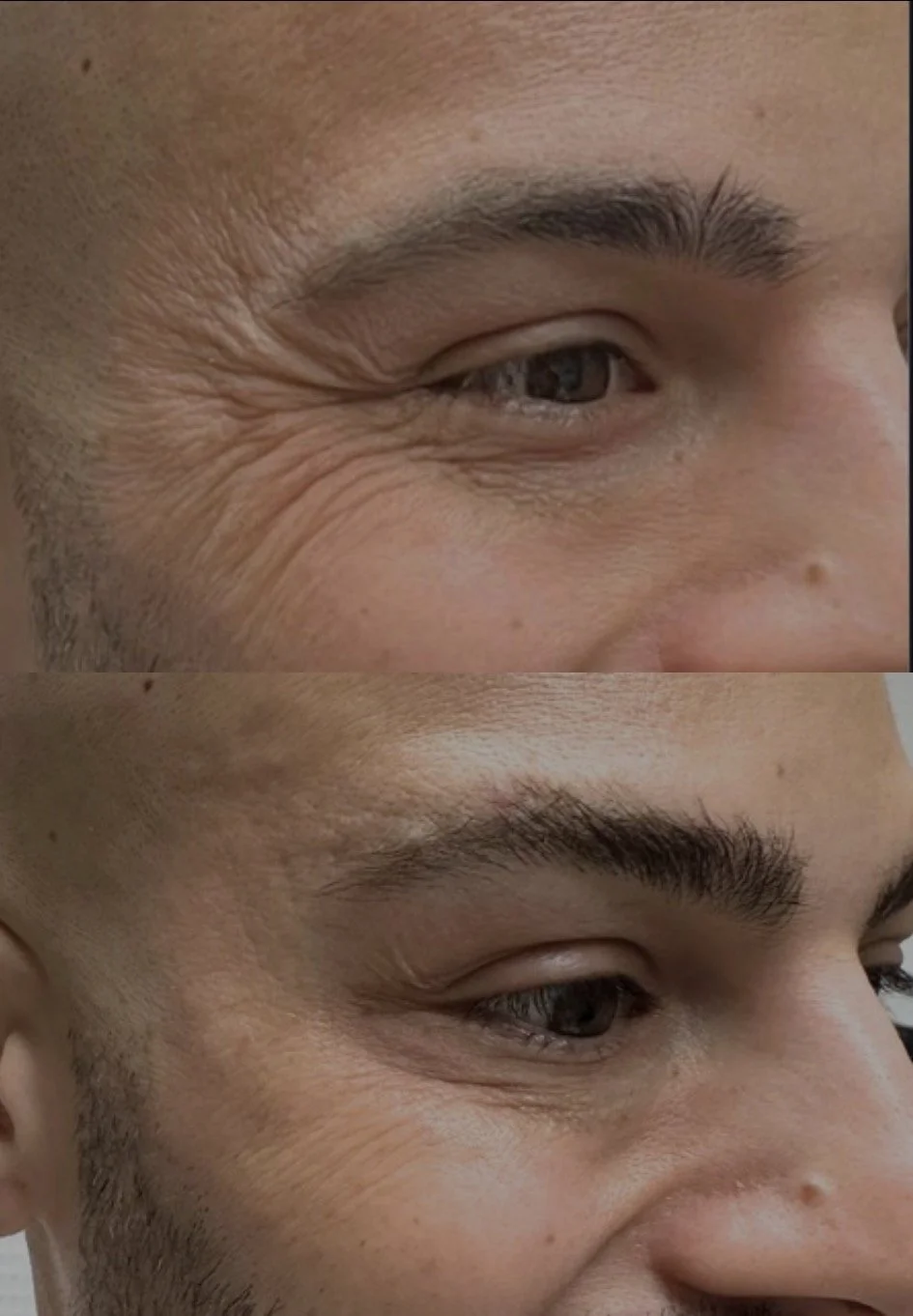 A side-by-side comparison of a person's eye area, showing the difference before and after eyebrow grooming. The top image shows the eye with less groomed eyebrows and visible wrinkles around the eye, while the bottom image shows the eye with well-gro